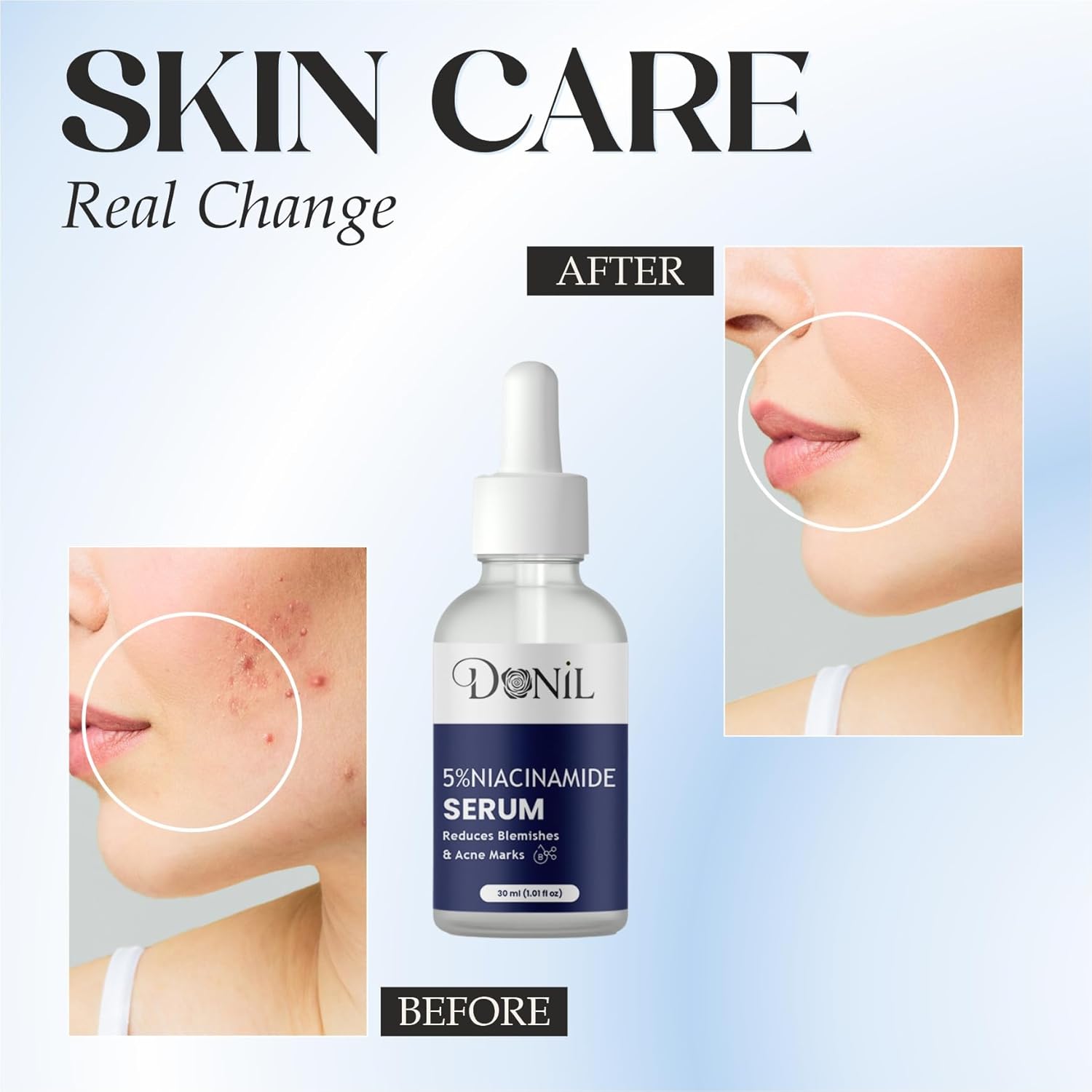 Donil 5% Niacinamide Serum for Face