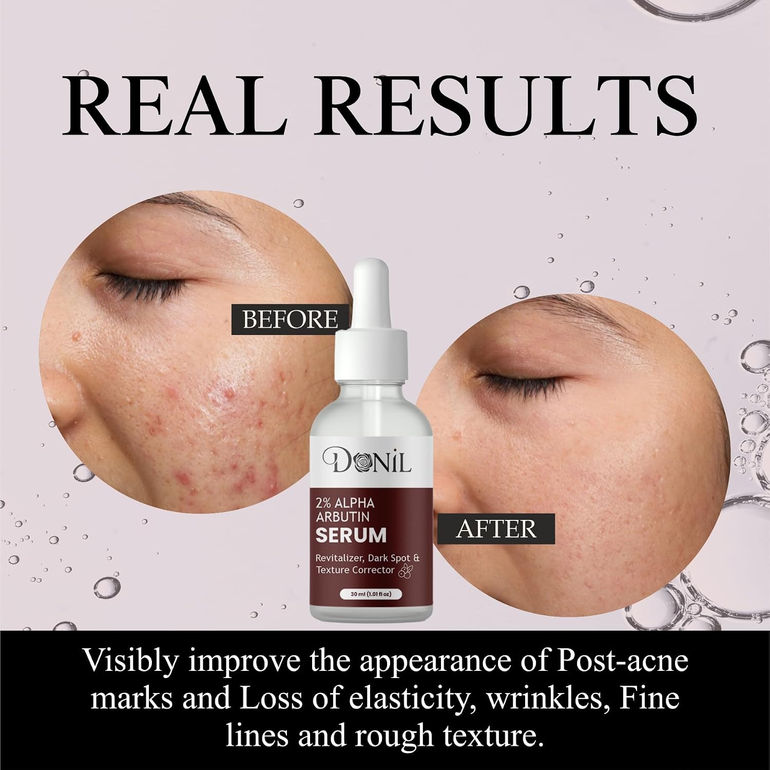 Donil 2% Alpha Arbutin Serum for Face