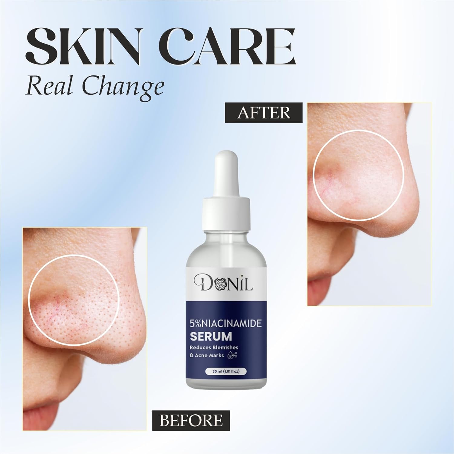 Donil 5% Niacinamide Serum for Face