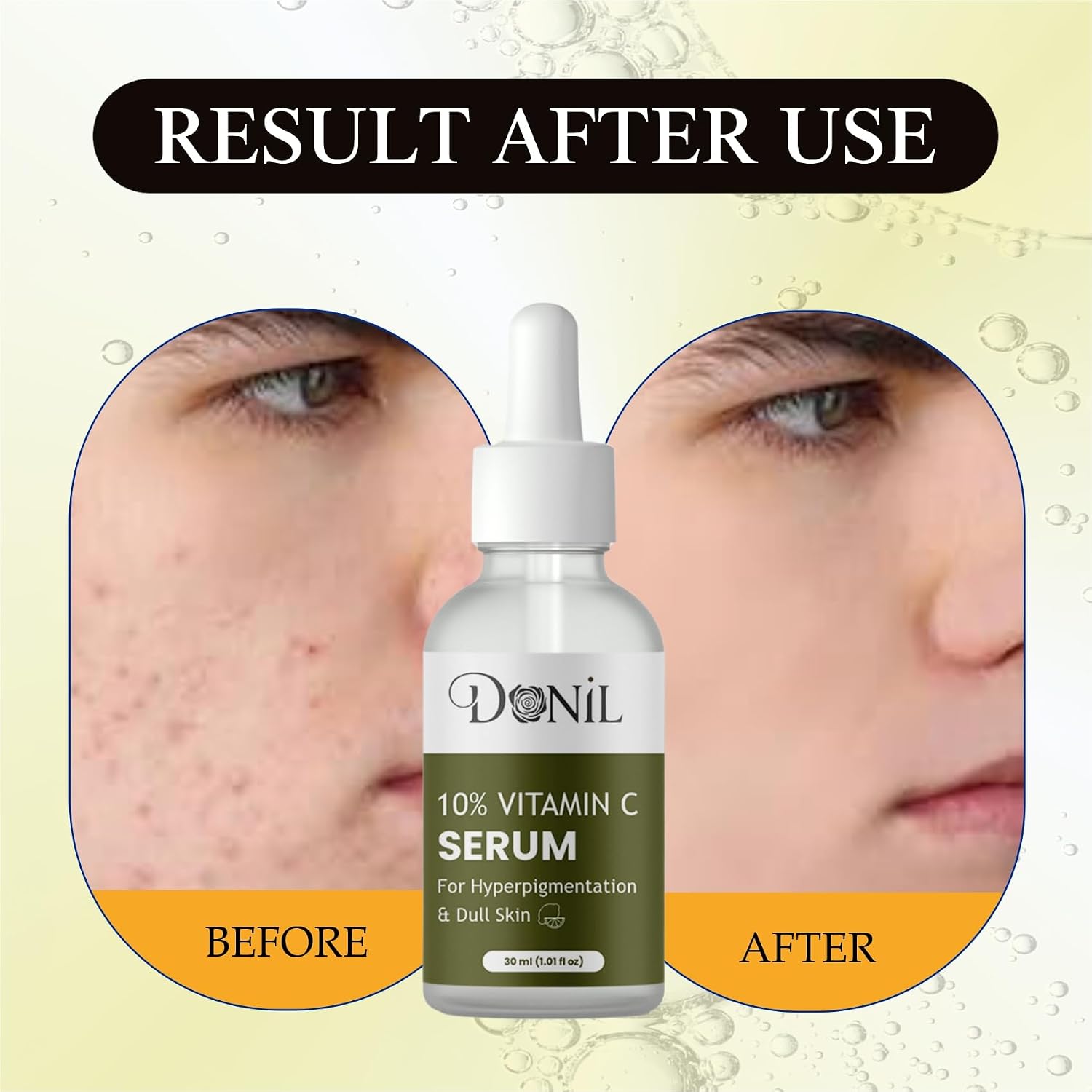 Donil 10% Vitamin C Serum for Face